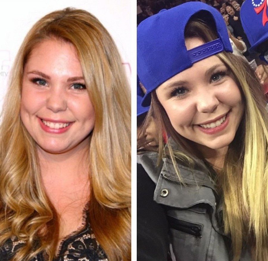 Kailyn Lowry plastic surgery 08
