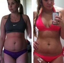 Kailyn Lowry plastic surgery 1