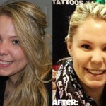 Kailyn-Lowry-plastic-surgery-11