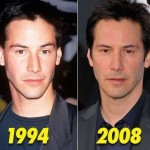 Keanu Reeves before and after plastic surgery