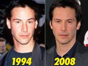 Keanu Reeves before and after plastic surgery