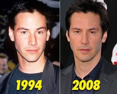Keanu Reeves before and after plastic surgery