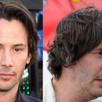 Keanu Reeves before and after plastic surgery 03