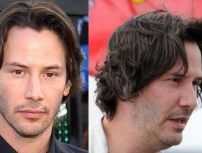 Keanu Reeves before and after plastic surgery 03