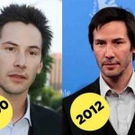 Keanu Reeves before and after plastic surgery 04