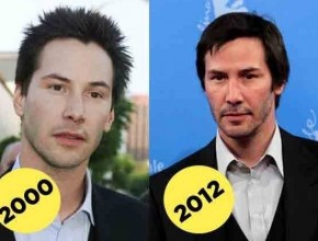 Keanu Reeves before and after plastic surgery 04