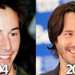 Keanu Reeves before and after plastic surgery 05