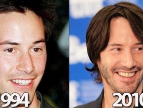 Keanu Reeves before and after plastic surgery 05