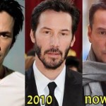 Keanu Reeves plastic surgery - then and now