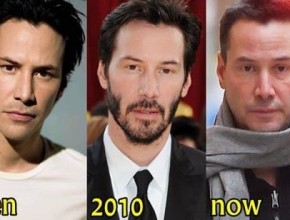 Keanu Reeves plastic surgery - then and now
