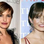 Mariska Hargitay before and after plastic surgery (1)