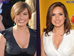 Mariska Hargitay before and after plastic surgery (2)