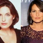 Mariska Hargitay before and after plastic surgery