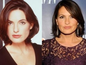 Mariska Hargitay before and after plastic surgery