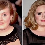 Adele before and after plastic surgery (11)