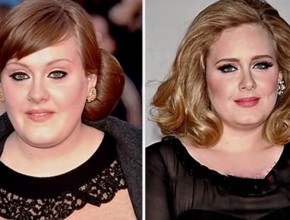 Adele before and after plastic surgery (11)