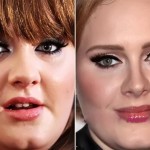 Adele before and after plastic surgery (13)