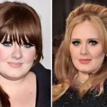 Adele before and after plastic surgery (14)