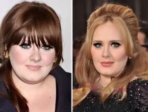 Adele before and after plastic surgery (14)