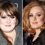 Adele before and after plastic surgery