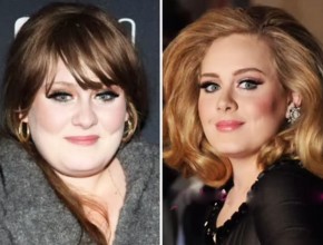 Adele before and after plastic surgery