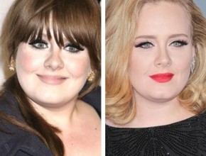 Adele before and after plastic surgery (18)