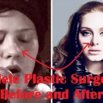 Adele before and after plastic surgery (21)