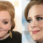 Adele before and after plastic surgery (4)