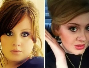 Adele before and after plastic surgery (9)