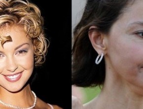 Ashley Judd Plastic Surgery (16)