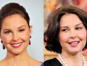 Ashley Judd before and after Plastic Surgery