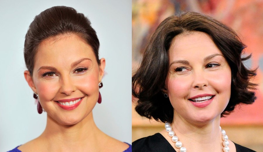 Ashley Judd before and after Plastic Surgery