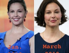 Ashley Judd before and after Plastic Surgery (14)