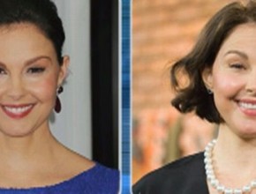 Ashley Judd before and after Plastic Surgery (2)
