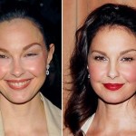 Ashley Judd before and after Plastic Surgery (28)