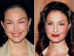 Ashley Judd before and after Plastic Surgery (28)