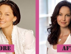 Ashley Judd before and after Plastic Surgery (29)