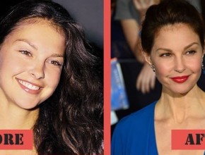 Ashley Judd before and after Plastic Surgery (30)