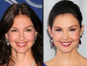 Ashley Judd before and after Plastic Surgery (6)