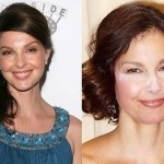 Ashley Judd before and after Plastic Surgery (8)
