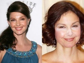 Ashley Judd before and after Plastic Surgery (8)