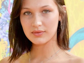 Bella Hadid before Plastic Surgery (6)