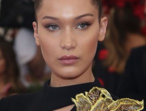 Bella Hadid after Plastic Surgery (7)