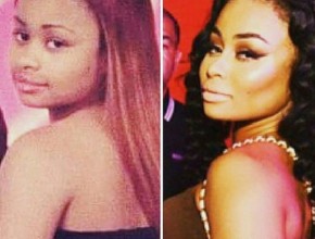 Blac Chyna before and after plastic surgery (22)