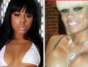 Blac Chyna before and after plastic surgery (23)