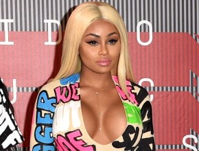 Blac Chyna plastic surgery (10)