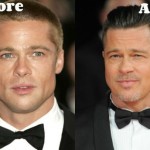 Brad Pitt before and after plastic surgery (14)