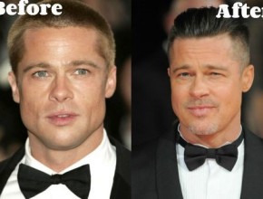 Brad Pitt before and after plastic surgery (14)