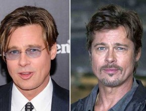 Brad Pitt before and after plastic surgery (15)