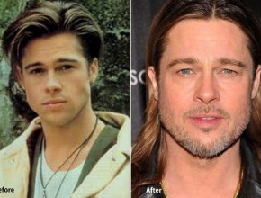 Brad Pitt before and after plastic surgery (21)
